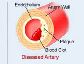 The-CHOLESTEROL-Myth-What-Causes-HEART-DISEASE-Abhi-Fit-Dubai-and-Online-Personal-Trainer-and-Nutrition-Coach-Abhinav-Malhotra-2